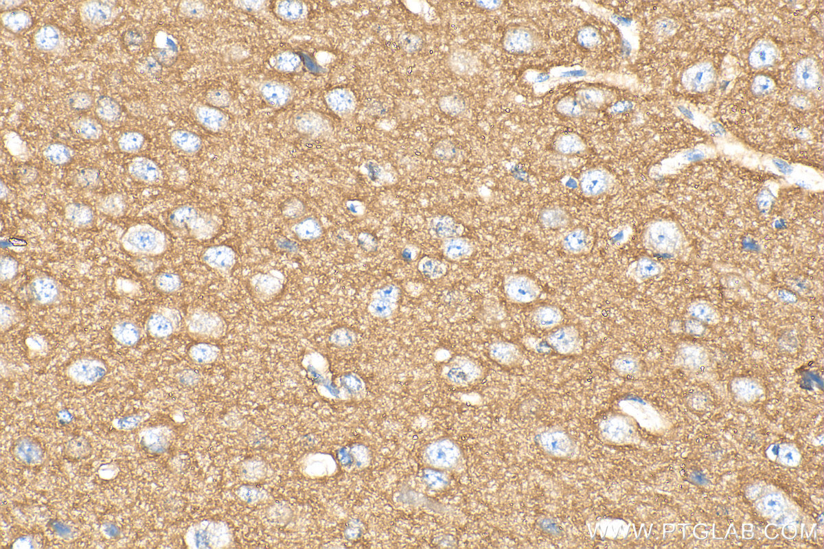IHC staining of mouse brain using 13850-1-AP
