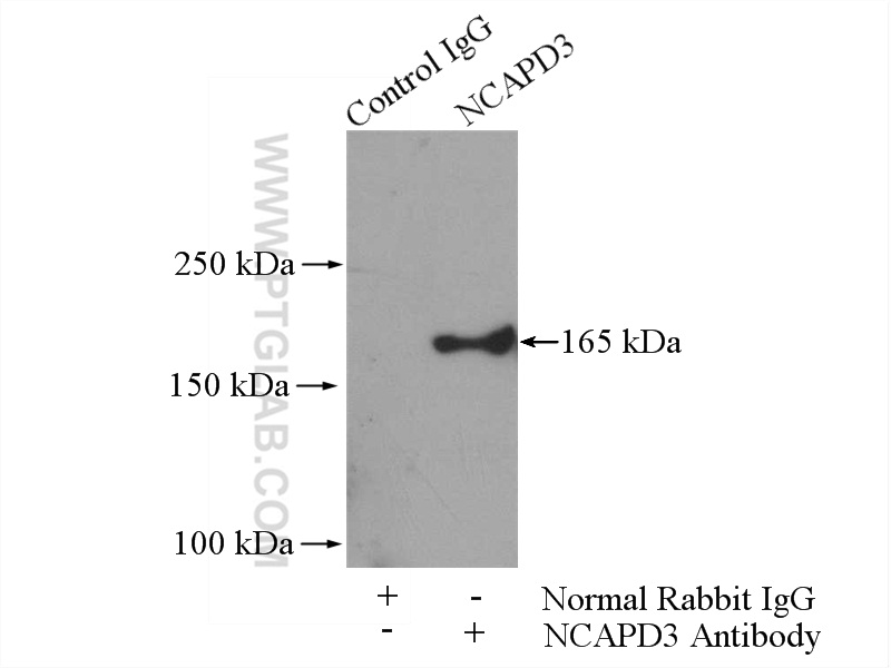 IP experiment of HeLa using 16828-1-AP