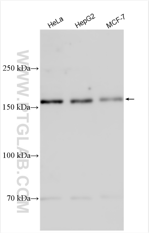 WB analysis using 16828-1-AP