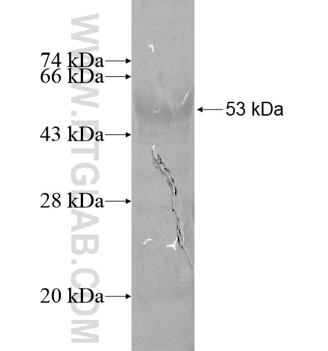 NCAPD3 fusion protein Ag10451 SDS-PAGE NCAPD3 fusion protein Ag10451 SDS-PAGE