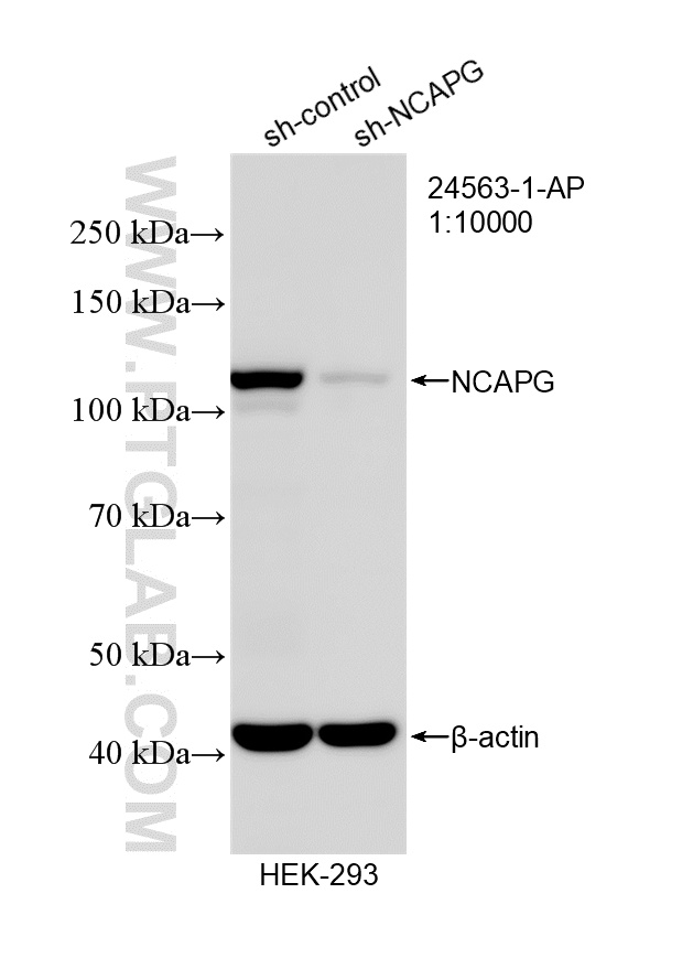 WB result of NCAPG antibody (24563-1-AP; 1:10000; incubated at room temperature for 1.5 hours) with sh-Control and sh-NCAPG transfected HEK-293 cells. WB analysis of HEK-293 using 24563-1-AP
