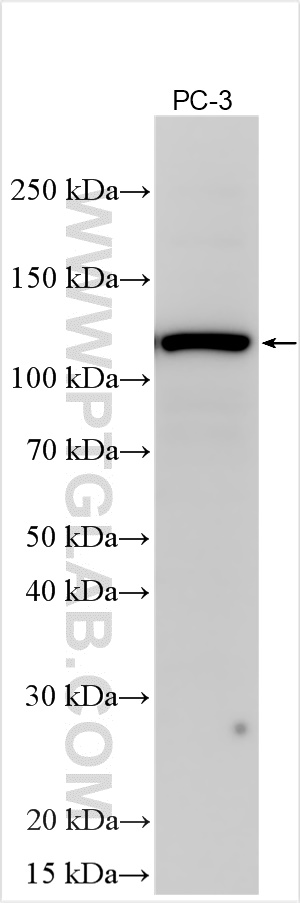 WB analysis using 32220-1-AP