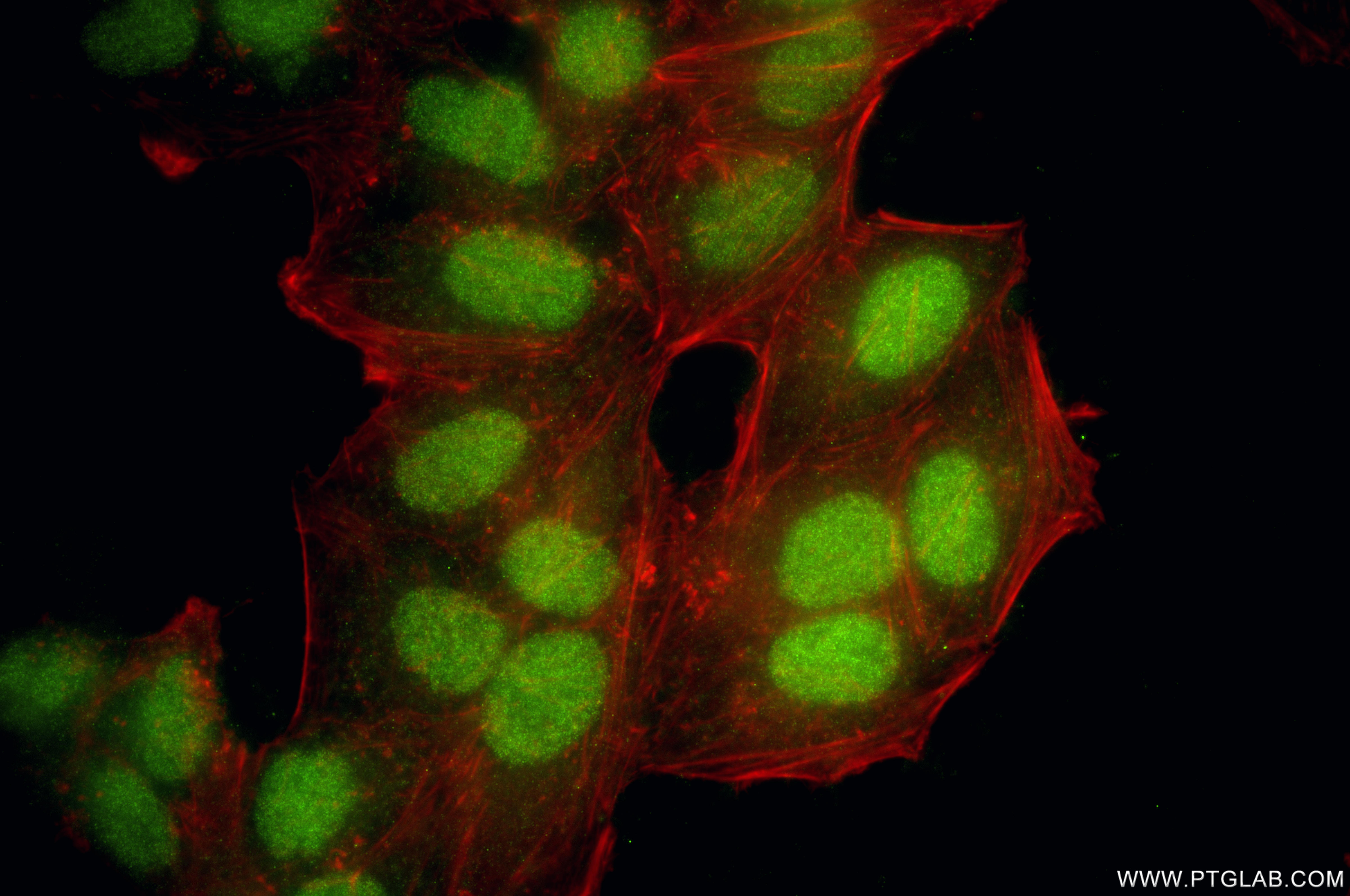 IF Staining of HepG2 using 87645-1-RR (same clone as 87645-1-PBS)