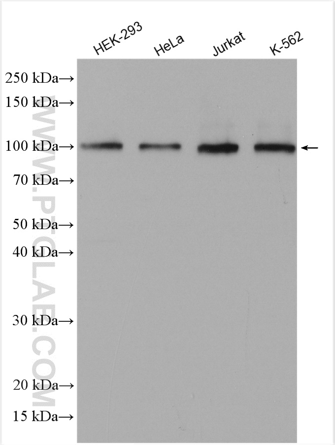 WB analysis using 11515-1-AP