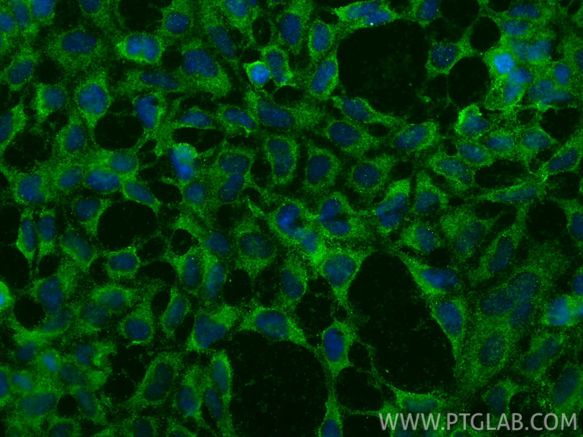 IF Staining of HEK-293 using 67655-1-Ig IF Staining of HEK-293 using 67655-1-Ig