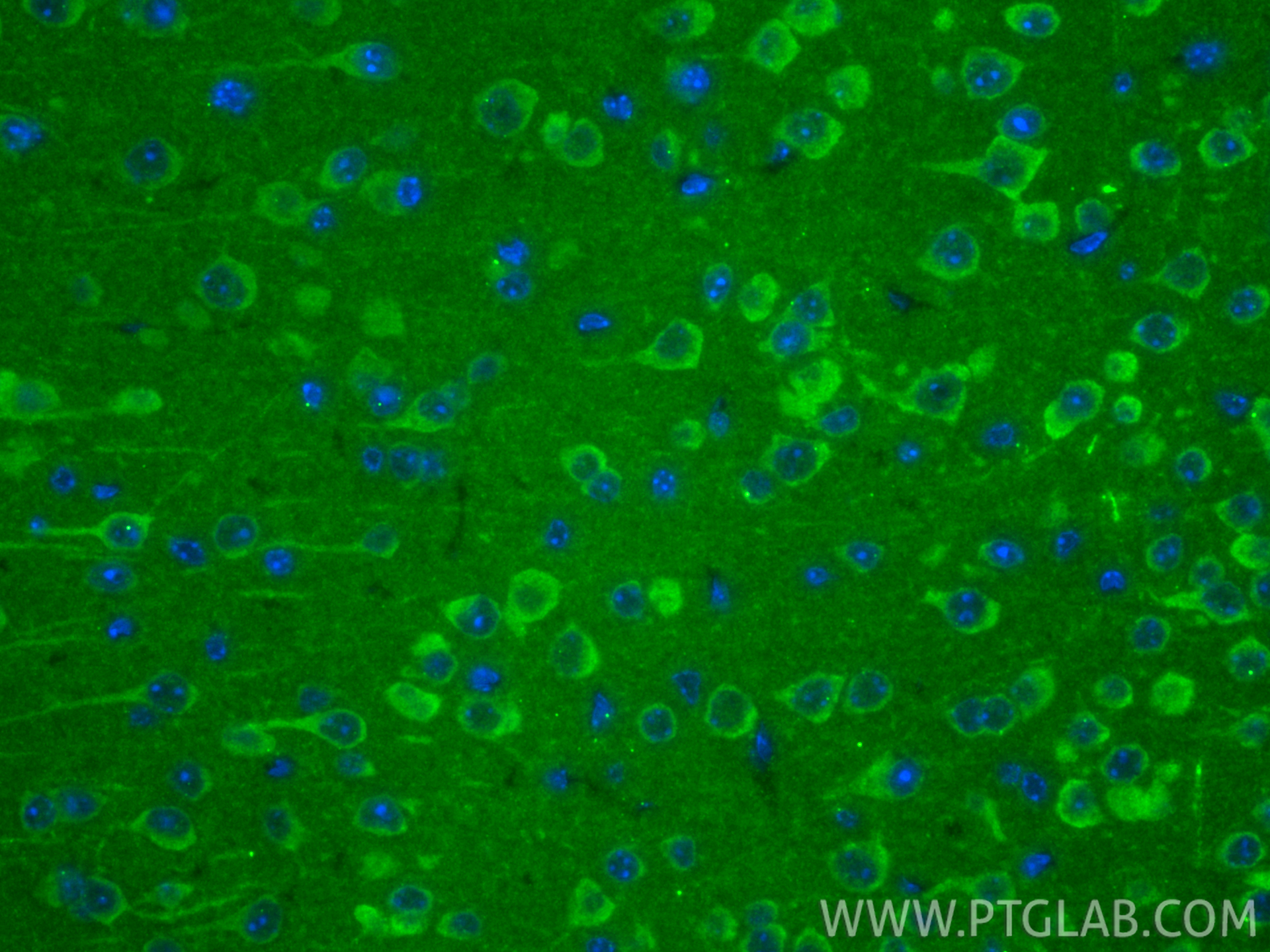 IF Staining of mouse brain using 13187-1-AP IF Staining of mouse brain using 13187-1-AP