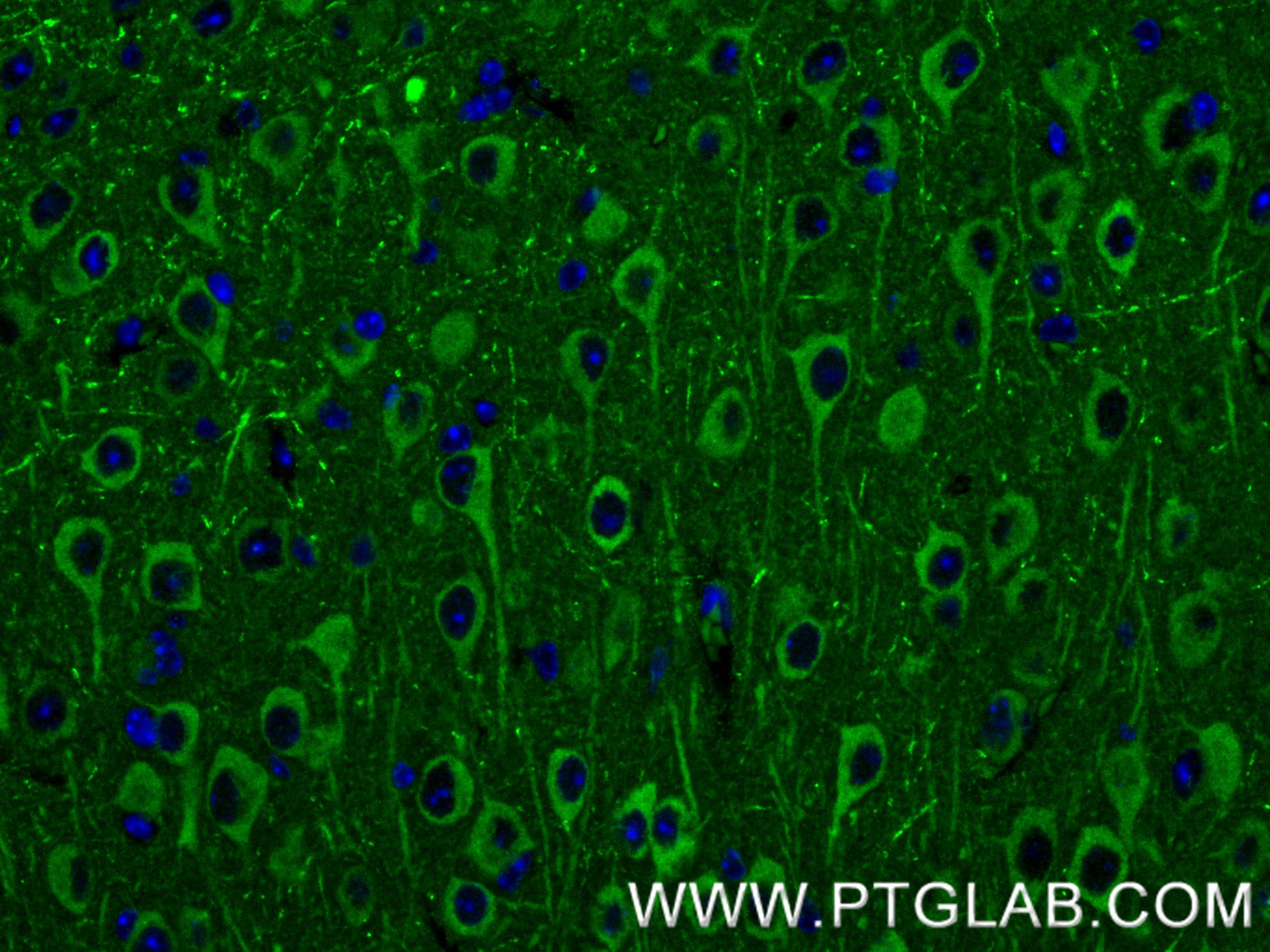 Immunofluorescent analysis of (4% PFA) fixed paraffin-embedded mouse brain tissue using NCDN antibody (85730-1-RR, Clone: 243146E2 ) at dilution of 1:400 and CoraLite®488-Conjugated Goat Anti-Rabbit IgG(H+L) (<a class='green' href='/productredirect?CatalogNo=SA00013-2' target='_blank'>SA00013-2</a>). Heat mediated antigen retrieval with Tris-EDTA buffer (pH 9.0). IF Staining of mouse brain using 85730-1-RR