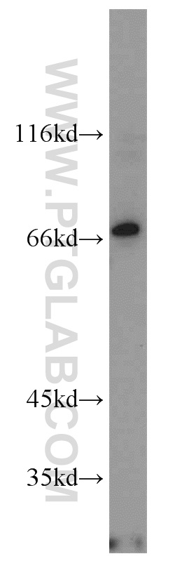 NOXA2/p67phox Polyclonal antibody