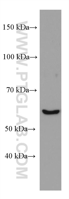 WB analysis of HepG2 using 67594-1-Ig