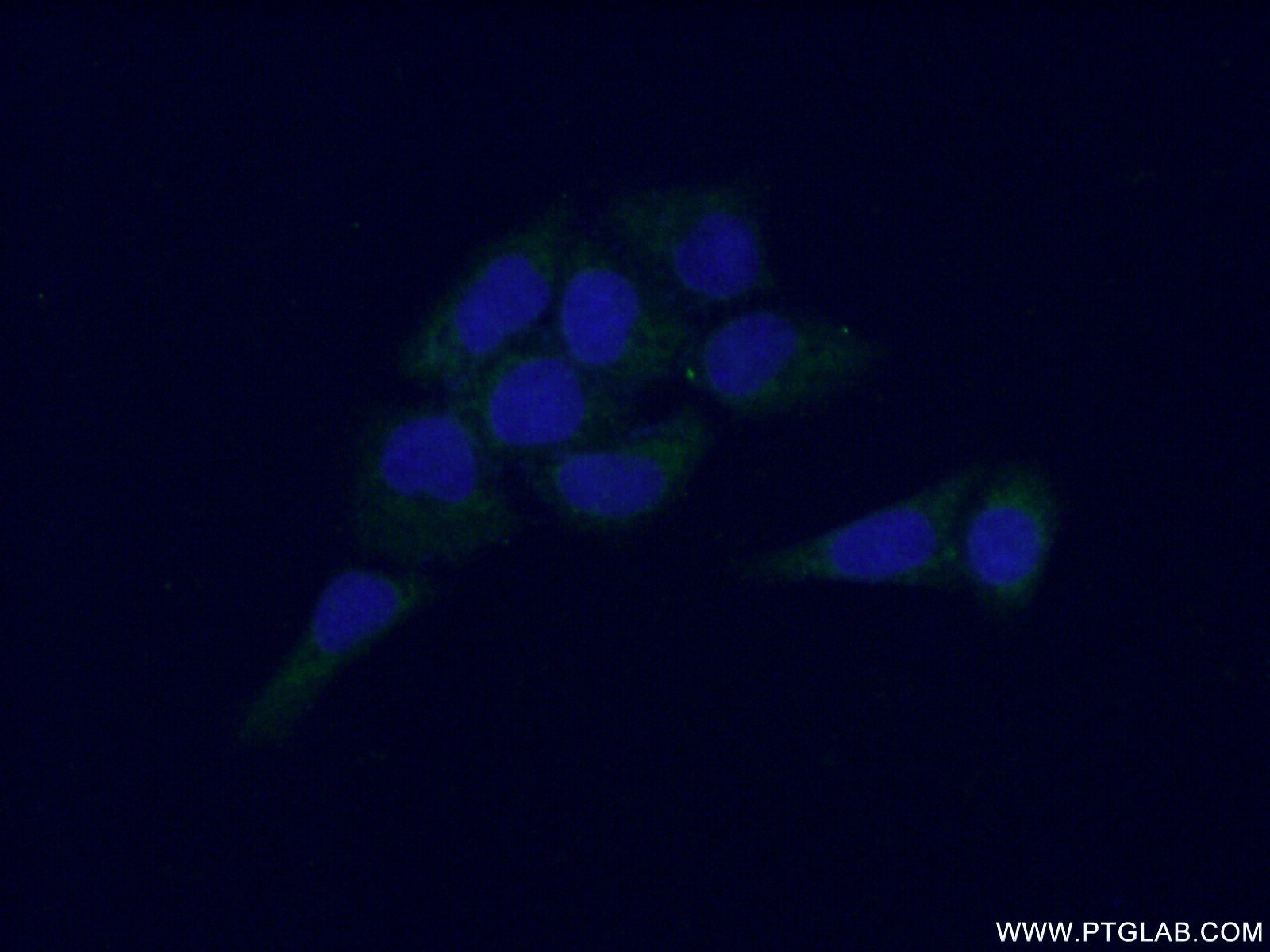 IF Staining of L02 using 14648-1-AP