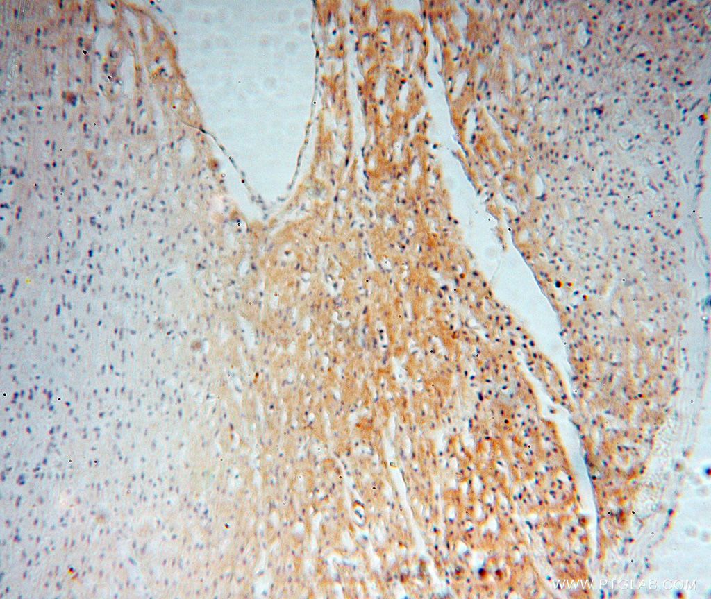 IHC staining of human heart using 14648-1-AP