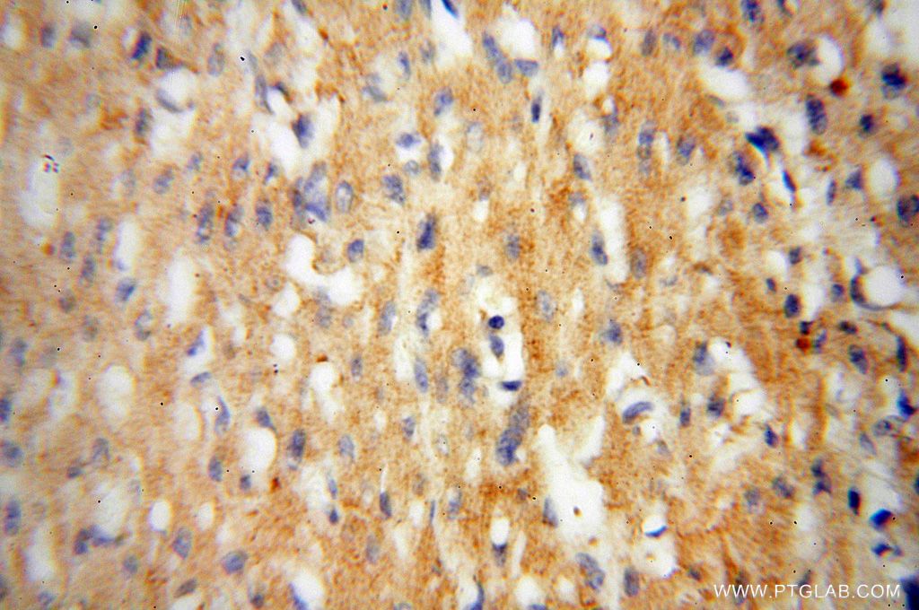 IHC staining of human heart using 14648-1-AP