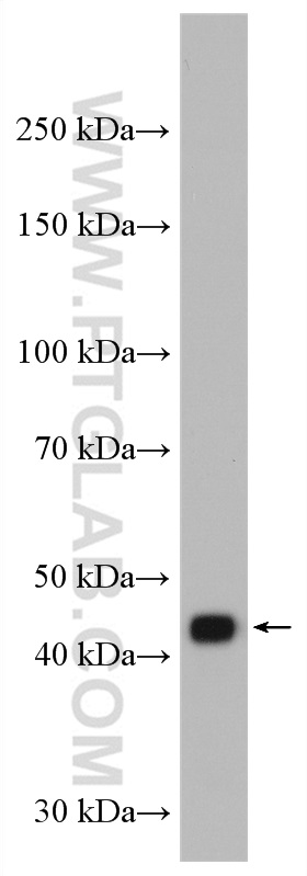 WB analysis of mouse brain using 15247-1-AP