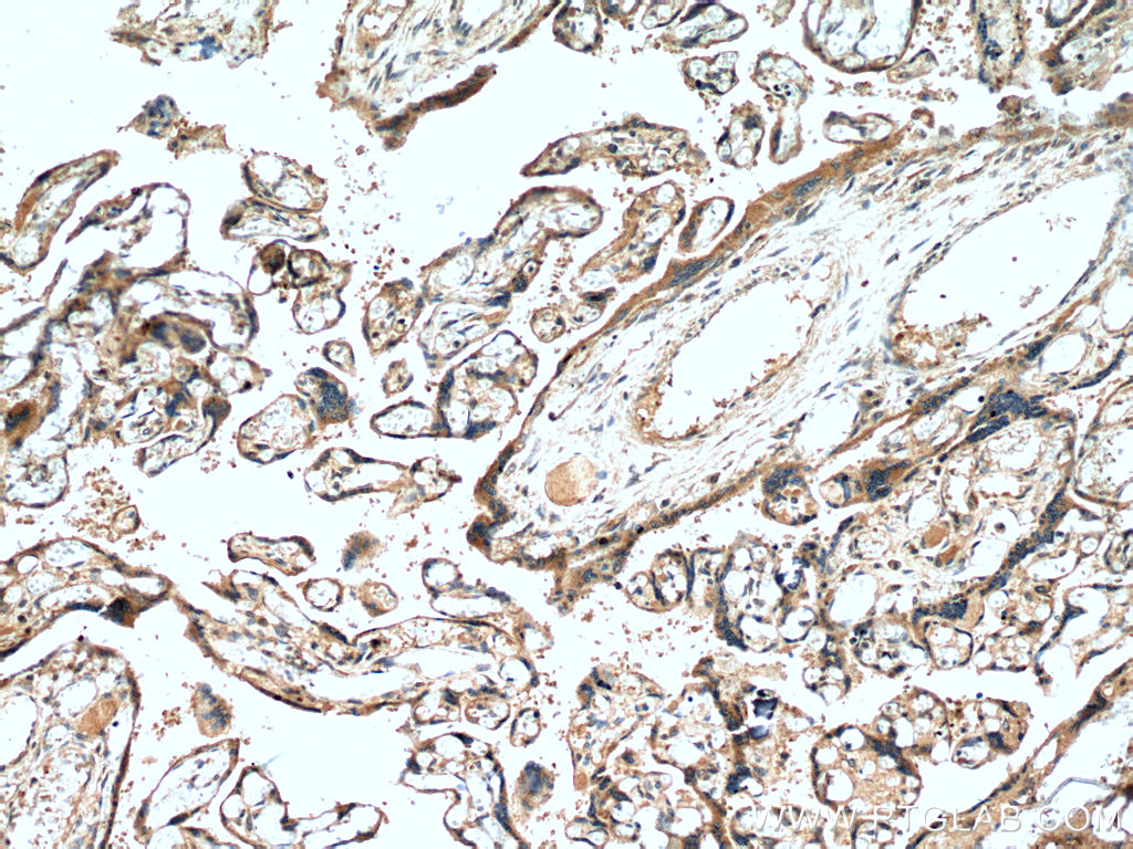 IHC staining of human placenta using 10206-1-AP