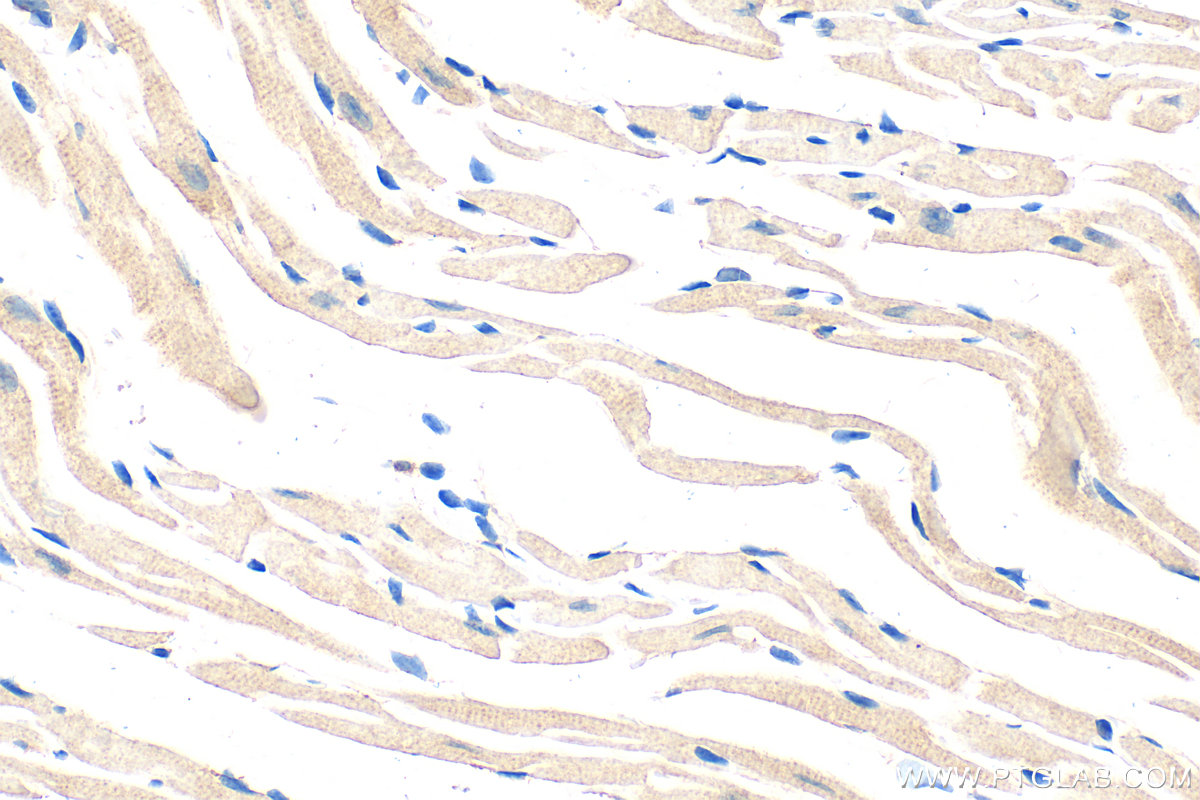 Immunohistochemical analysis of paraffin-embedded mouse heart tissue slide using 12140-1-AP (NCKAP1 antibody) at dilution of 1:200 (under 40x lens). Heat mediated antigen retrieval with Tris-EDTA buffer (pH 9.0). IHC staining of mouse heart using 12140-1-AP