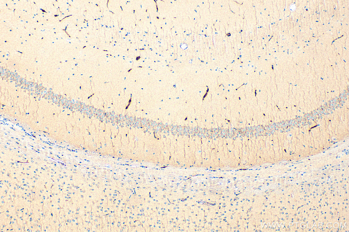 Immunohistochemical analysis of paraffin-embedded mouse brain tissue slide using 12140-1-AP (NCKAP1 antibody) at dilution of 1:200 (under 10x lens). Heat mediated antigen retrieval with Tris-EDTA buffer (pH 9.0). IHC staining of mouse brain using 12140-1-AP