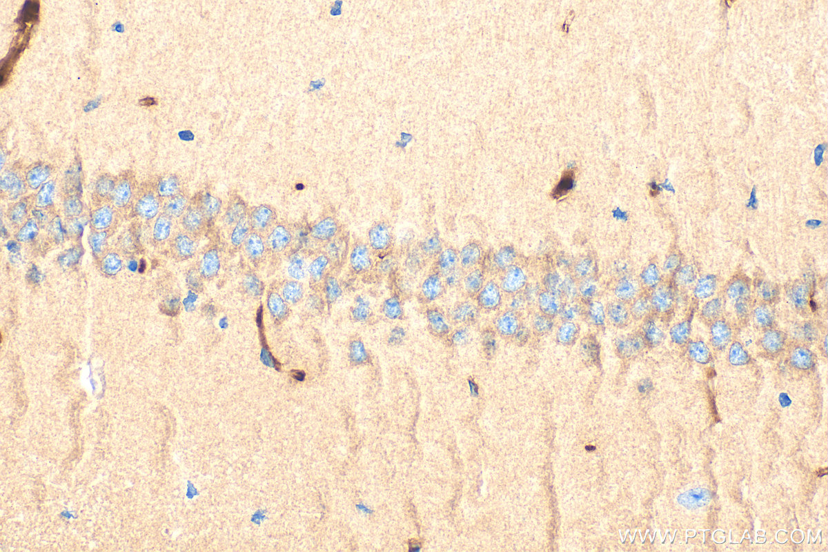 Immunohistochemical analysis of paraffin-embedded mouse brain tissue slide using 12140-1-AP (NCKAP1 antibody) at dilution of 1:200 (under 40x lens). Heat mediated antigen retrieval with Tris-EDTA buffer (pH 9.0). IHC staining of mouse brain using 12140-1-AP