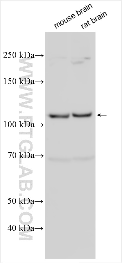 WB analysis using 12140-1-AP