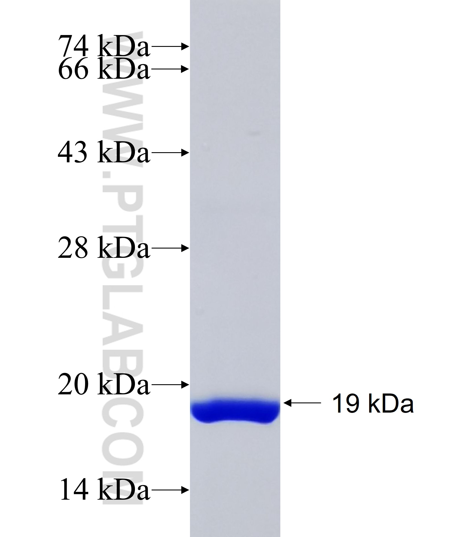 NCKAP5 fusion protein Ag35181 SDS-PAGE NCKAP5 fusion protein Ag35181 SDS-PAGE