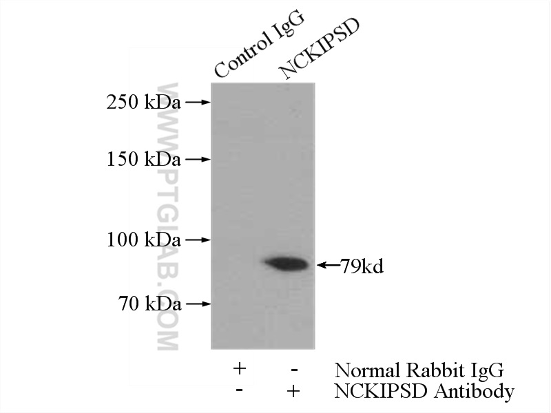 IP experiment of mouse brain using 11367-1-AP