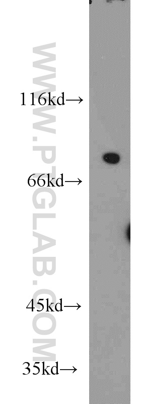 WB analysis of mouse brain using 11367-1-AP