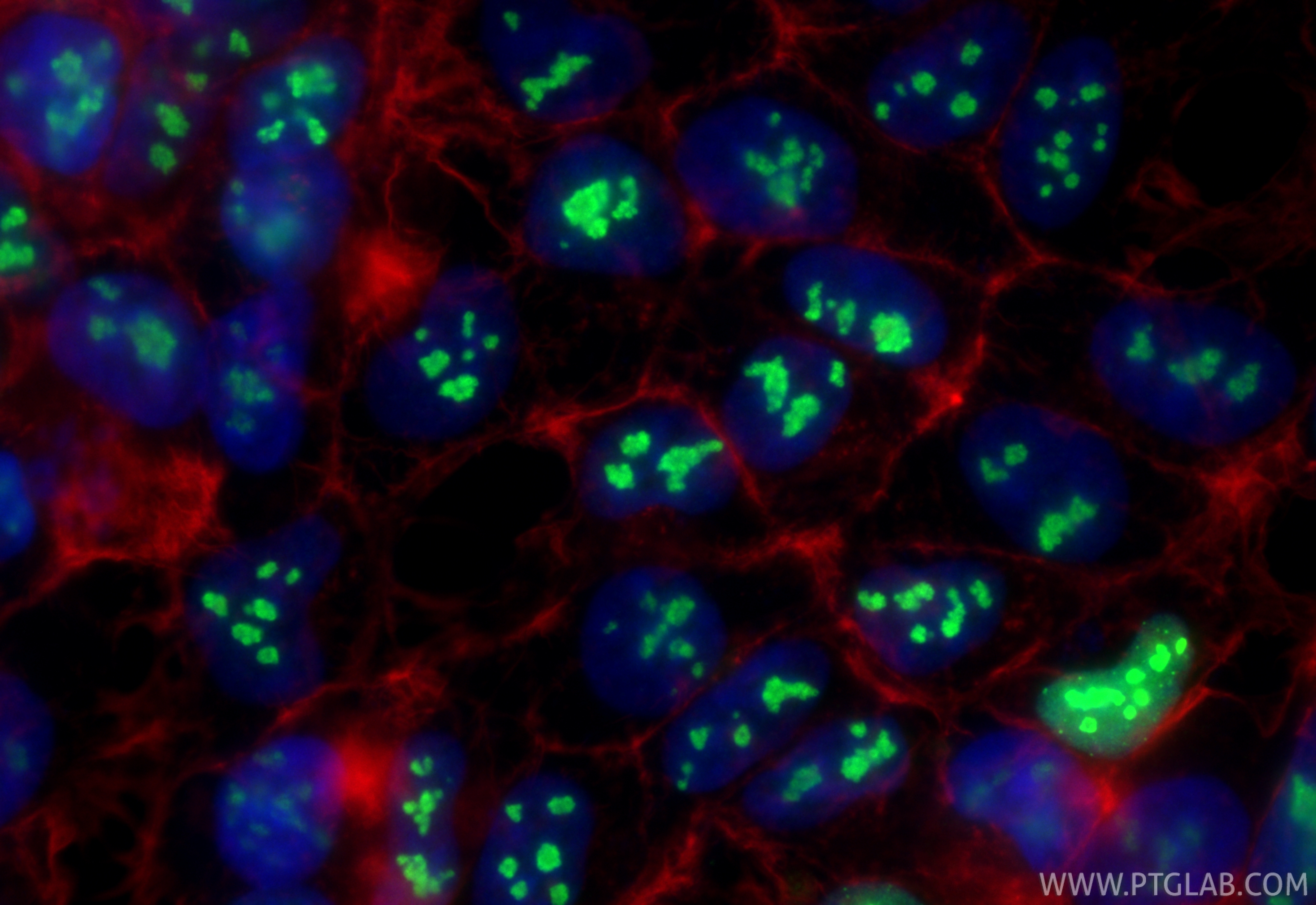IF Staining of HEK-293 using 83380-1-RR IF Staining of HEK-293 using 83380-1-RR