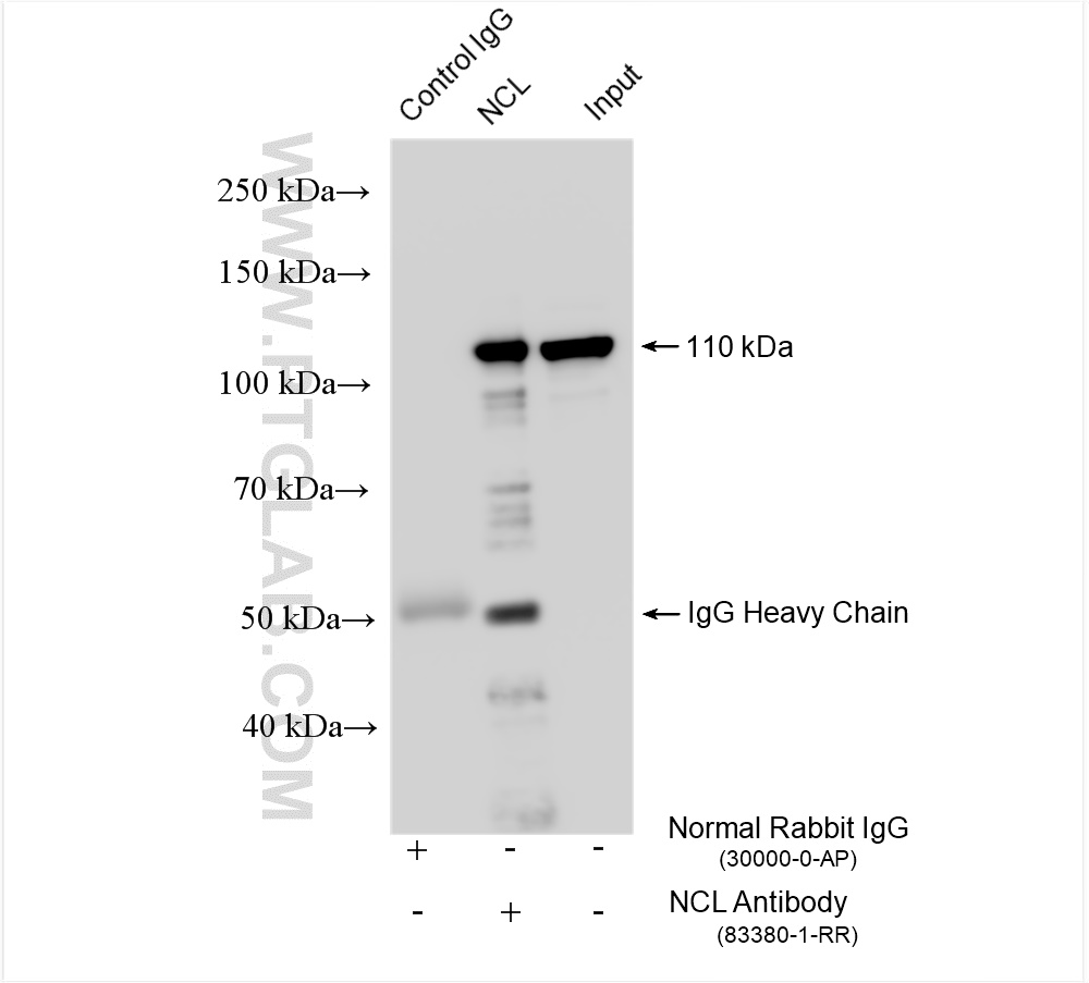 IP experiment of HeLa using 83380-1-RR (same clone as 83380-1-PBS)