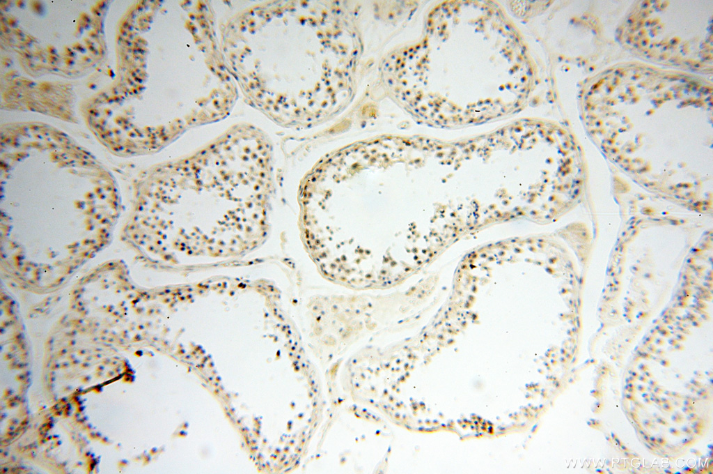 IHC staining of human testis using 51114-1-AP