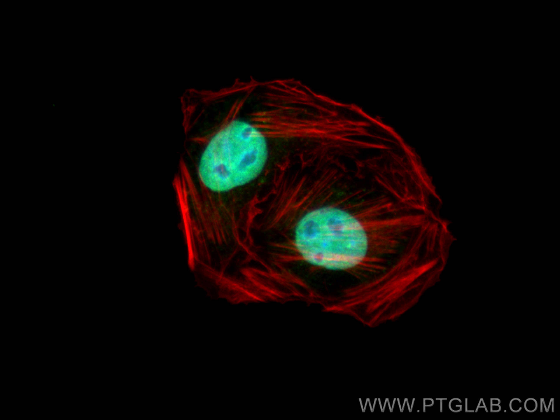 IF Staining of U2OS using 30962-1-AP