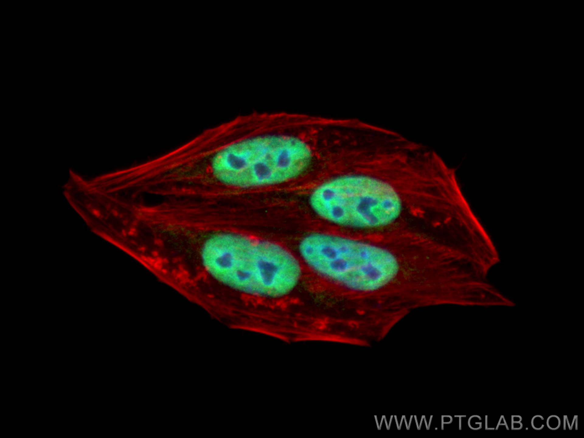 IF Staining of HepG2 using 30962-1-AP