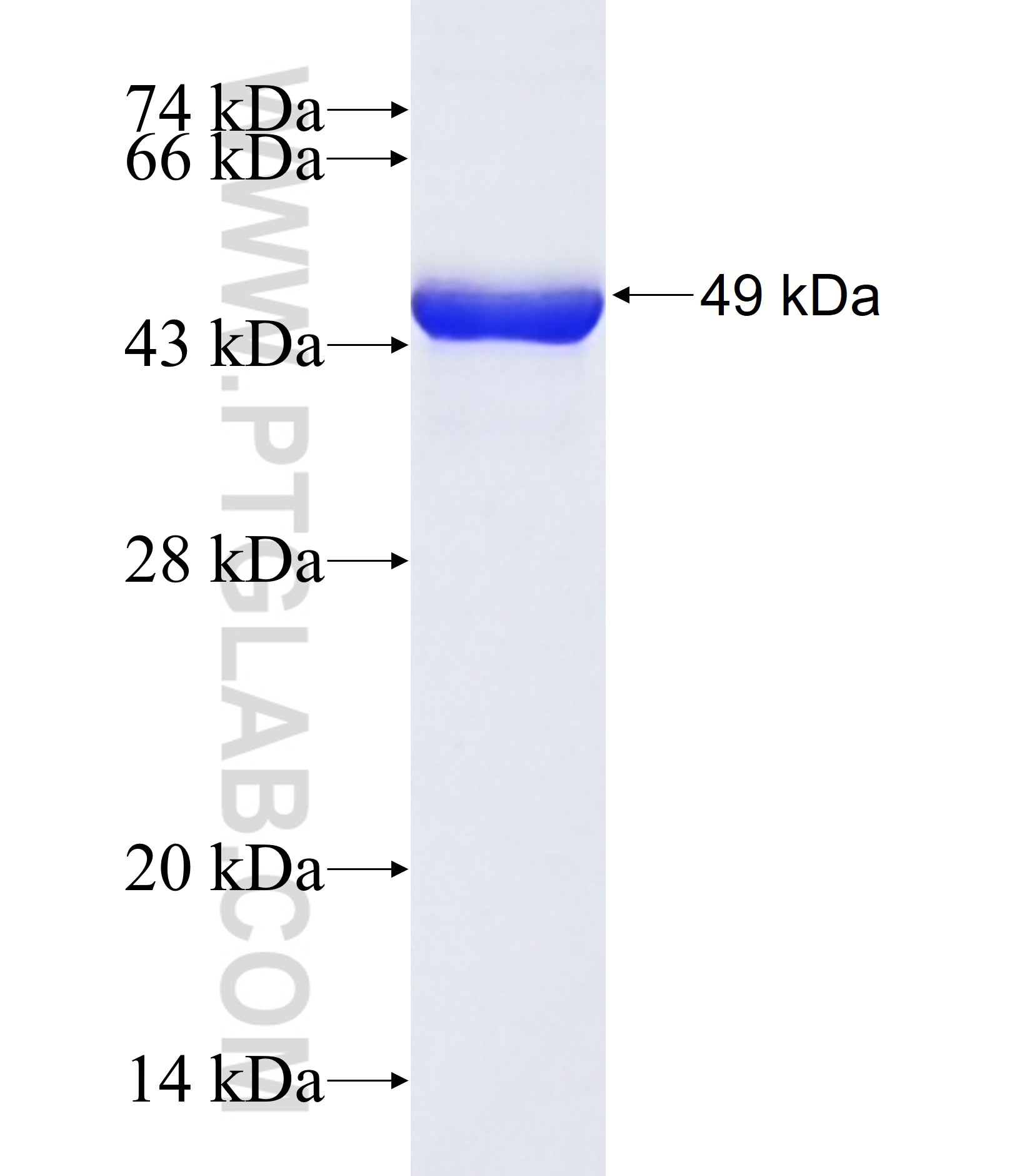 NCOA2 fusion protein Ag33395 SDS-PAGE NCOA2 fusion protein Ag33395 SDS-PAGE