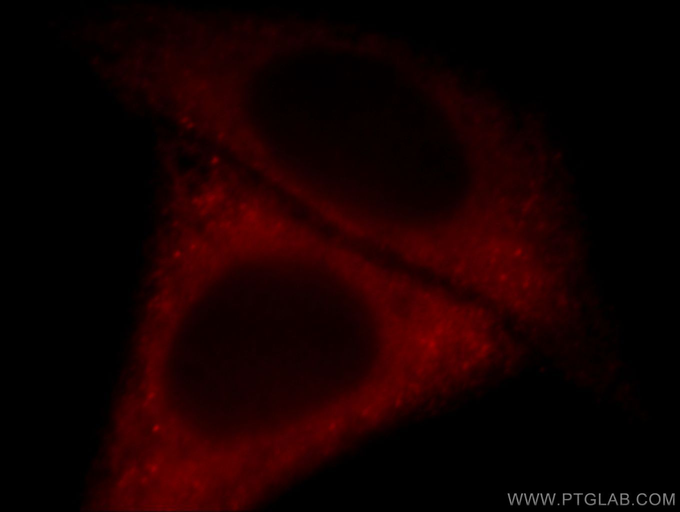 IF Staining of HepG2 using 20032-1-AP