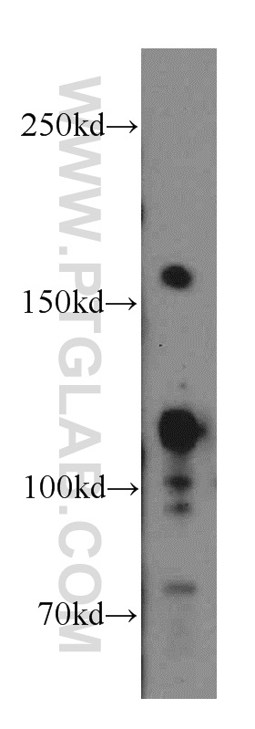 WB analysis of HeLa using 20032-1-AP