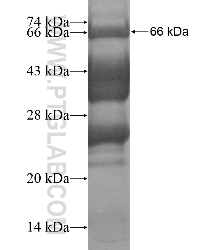 NCOA3 fusion protein Ag18434 SDS-PAGE NCOA3 fusion protein Ag18434 SDS-PAGE