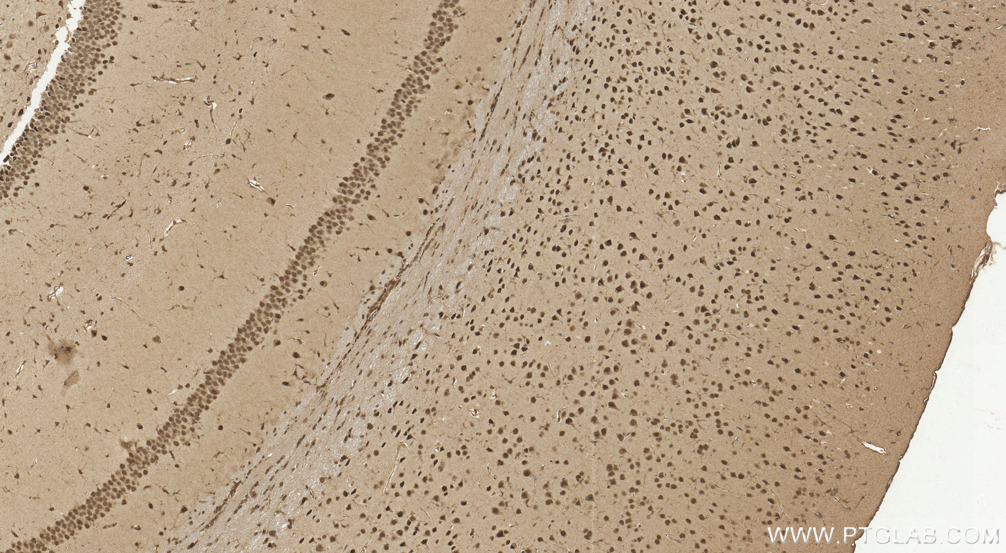 IHC staining of mouse brain using 10968-1-AP