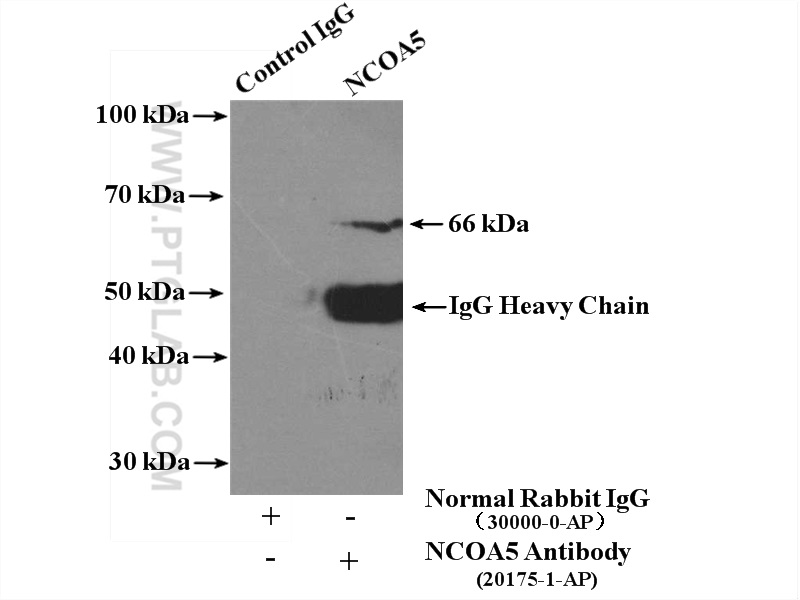 IP experiment of HEK-293 using 20175-1-AP