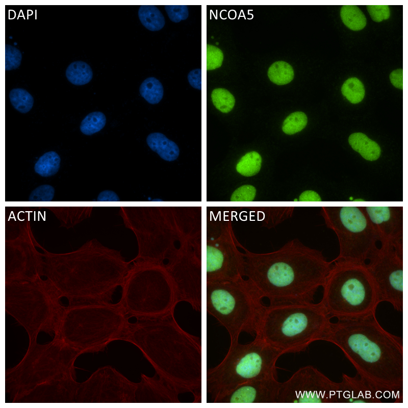 IF Staining of A431 using 85004-1-RR (same clone as 85004-1-PBS)