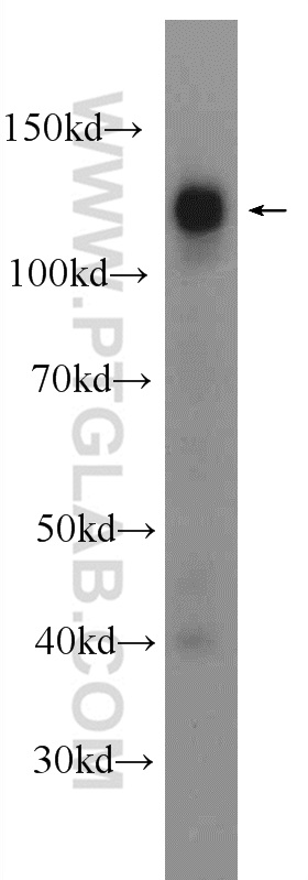 WB analysis of HEK-293 using 23092-1-AP