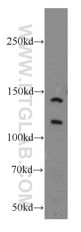 WB analysis of HepG2 using 20018-1-AP