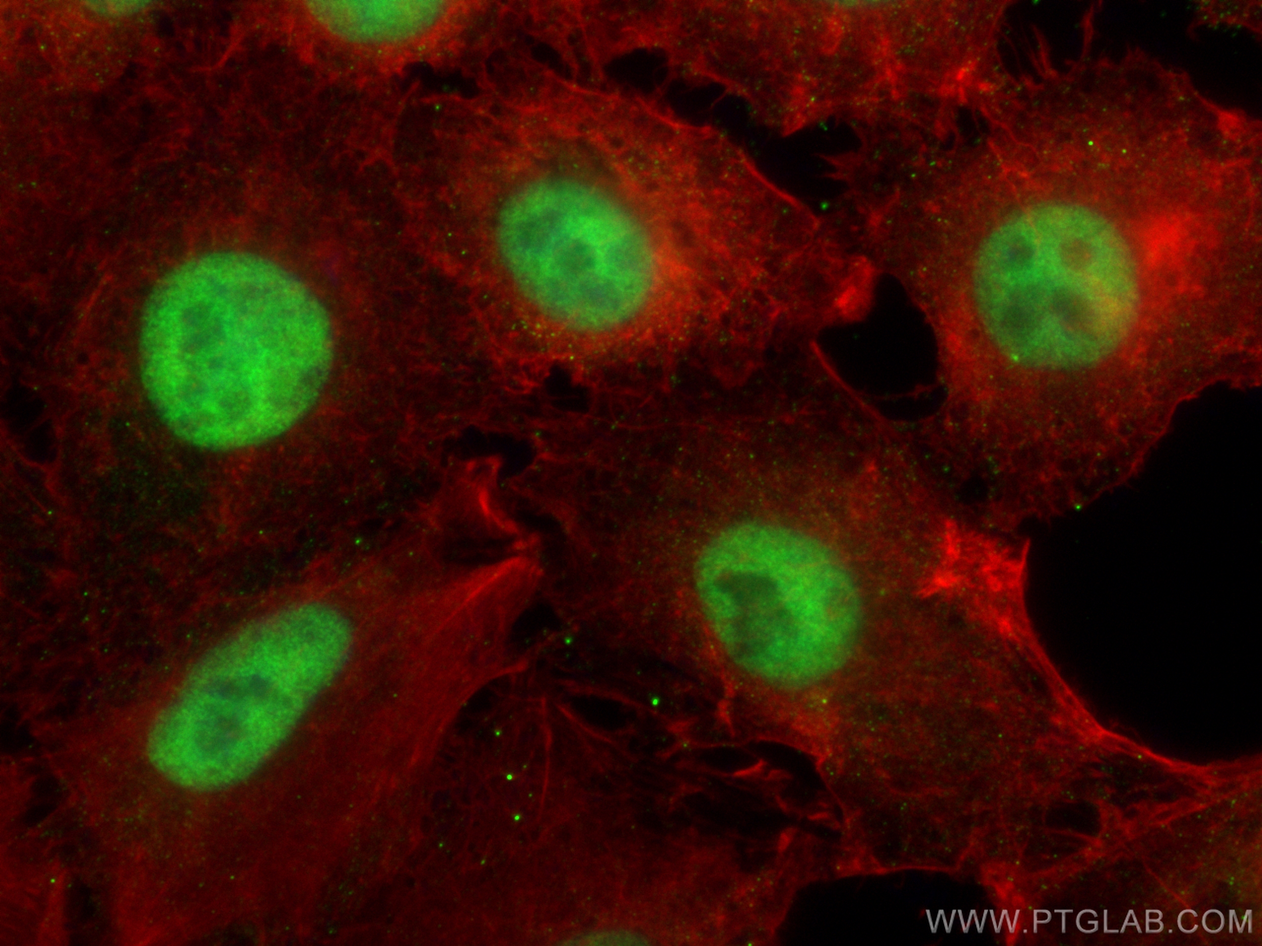 IF Staining of A549 using 29952-1-AP