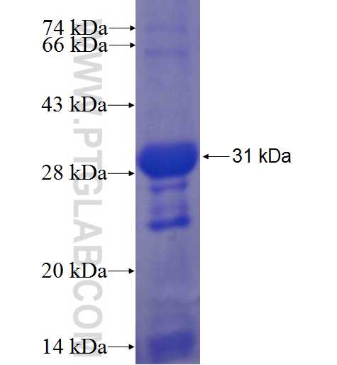 NCR1 fusion protein Ag6454 SDS-PAGE NCR1 fusion protein Ag6454 SDS-PAGE
