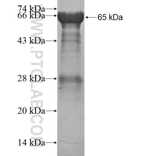 NCRNA00153 fusion protein Ag15454 SDS-PAGE