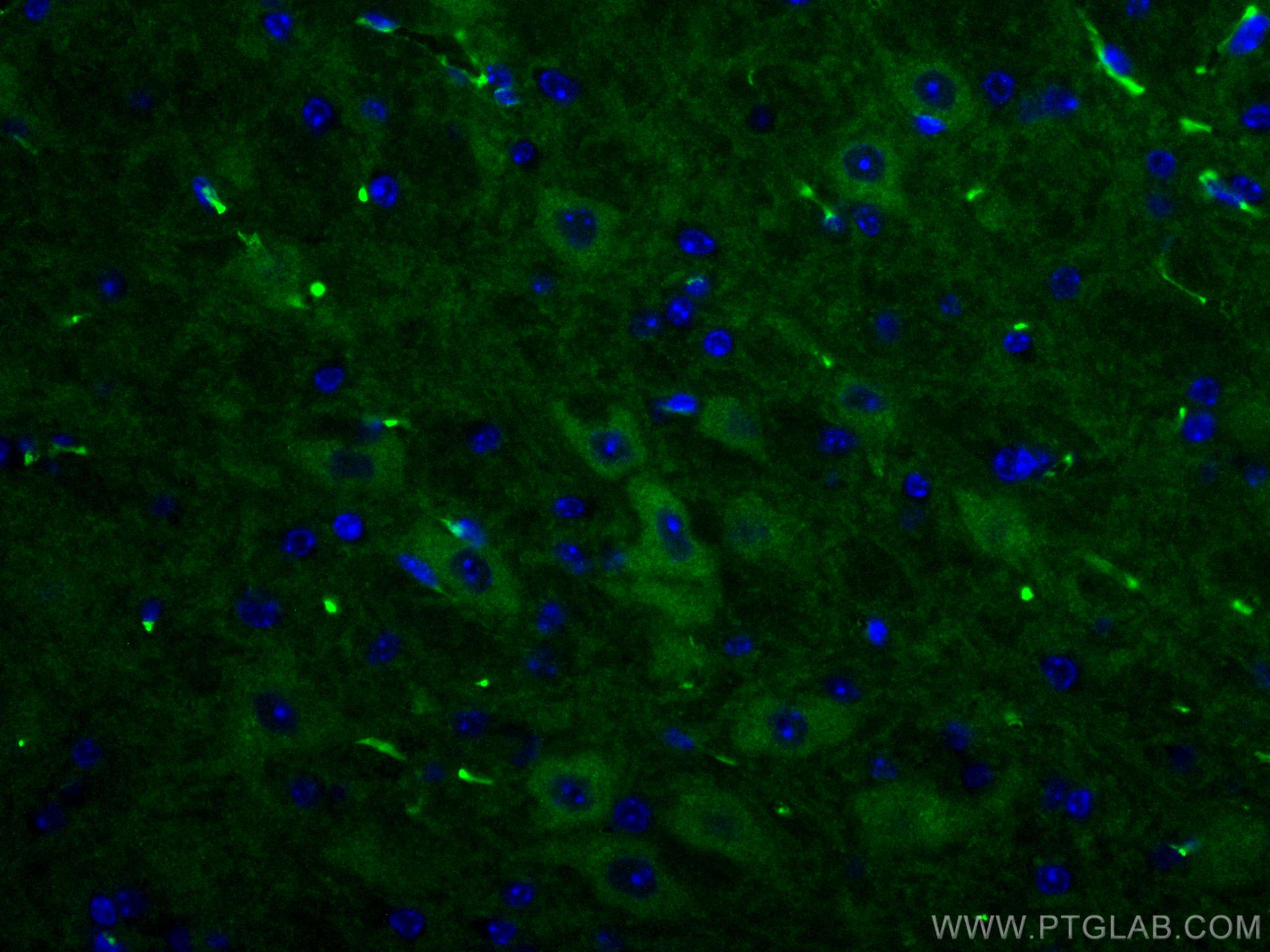 IF Staining of mouse brain using 67616-1-Ig (same clone as 67616-1-PBS)