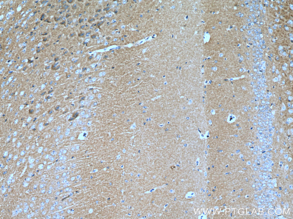 IHC staining of mouse brain using 67616-1-Ig (same clone as 67616-1-PBS)