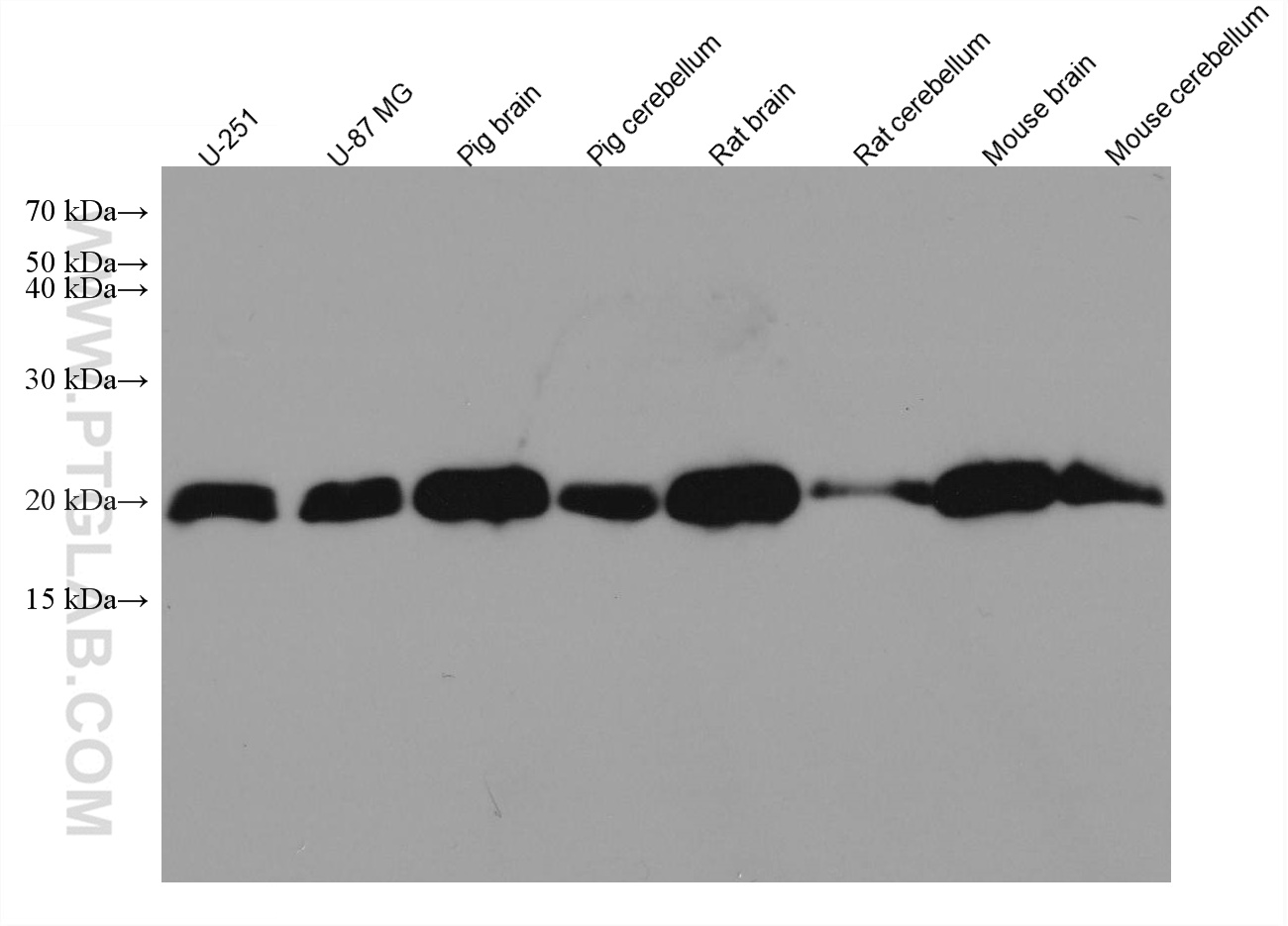 WB analysis using 67616-1-Ig (same clone as 67616-1-PBS)