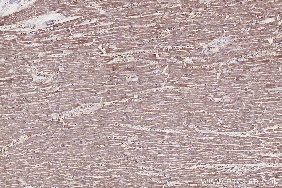 IHC staining of human heart using 19703-1-AP IHC staining of human heart using 19703-1-AP