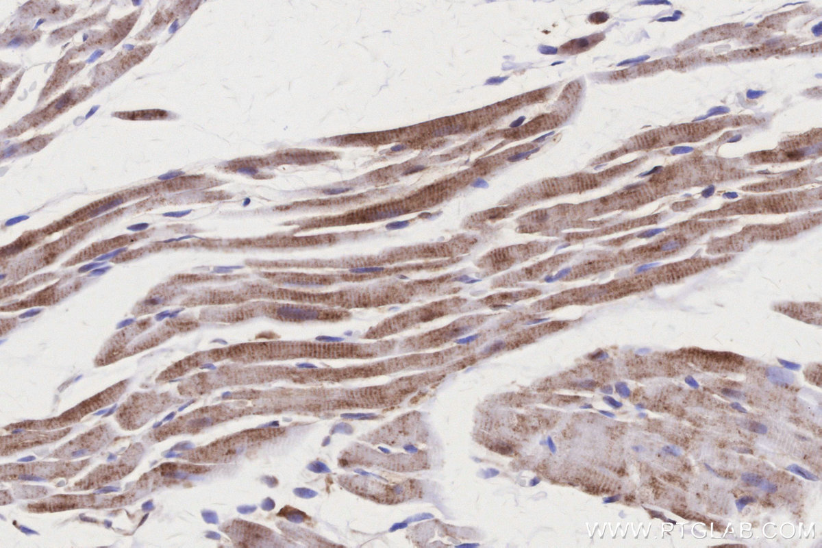 IHC staining of rat heart using 19703-1-AP IHC staining of rat heart using 19703-1-AP