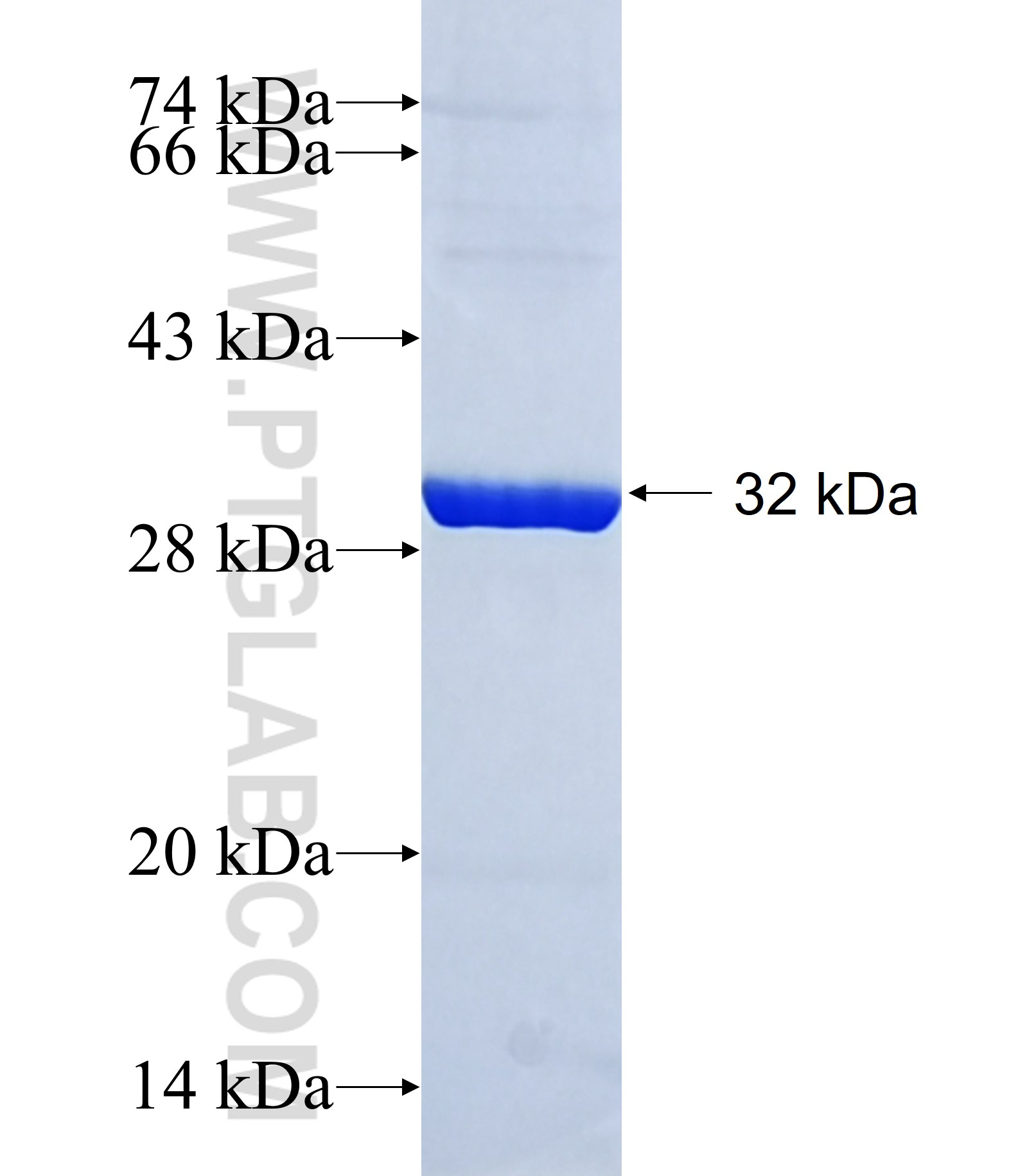 ND1 fusion protein Ag38976 SDS-PAGE ND1 fusion protein Ag38976 SDS-PAGE