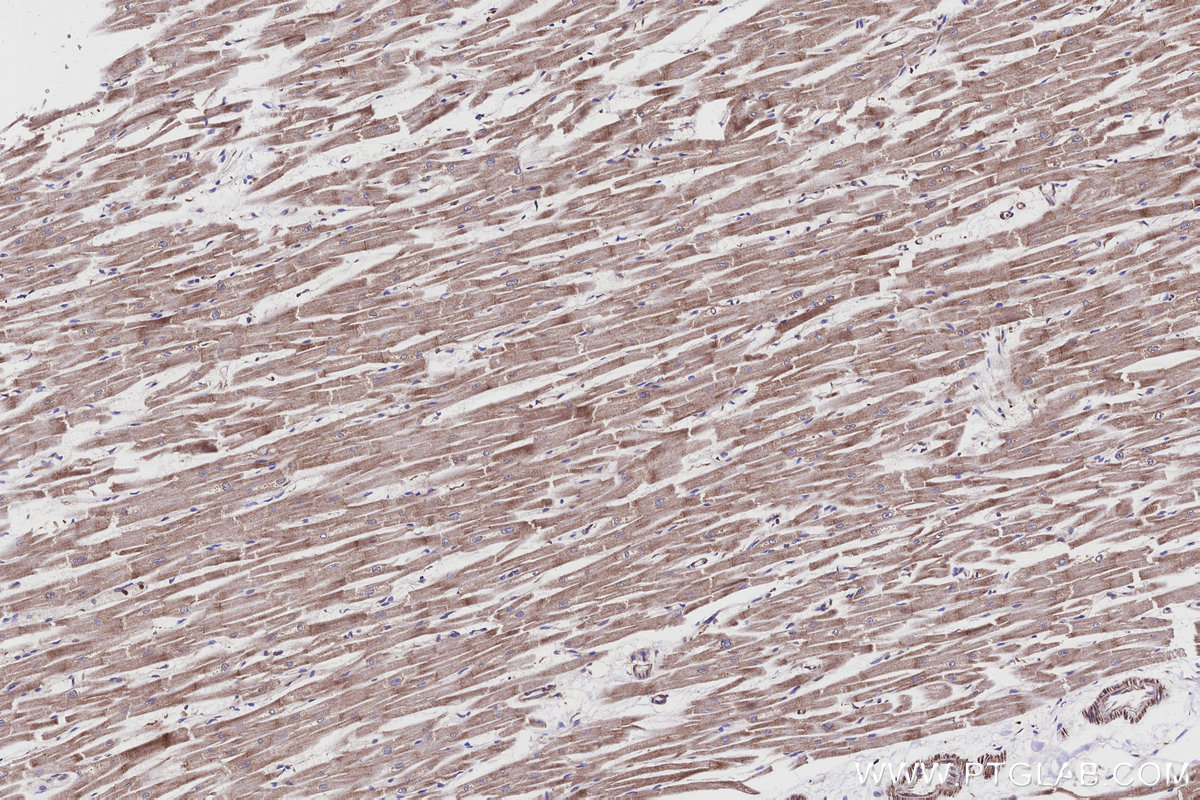 IHC staining of human heart using 19704-1-AP IHC staining of human heart using 19704-1-AP