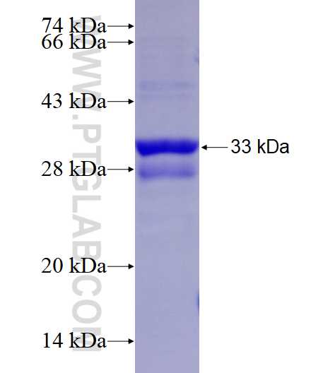 ND4L fusion protein Ag27285 SDS-PAGE ND4L fusion protein Ag27285 SDS-PAGE